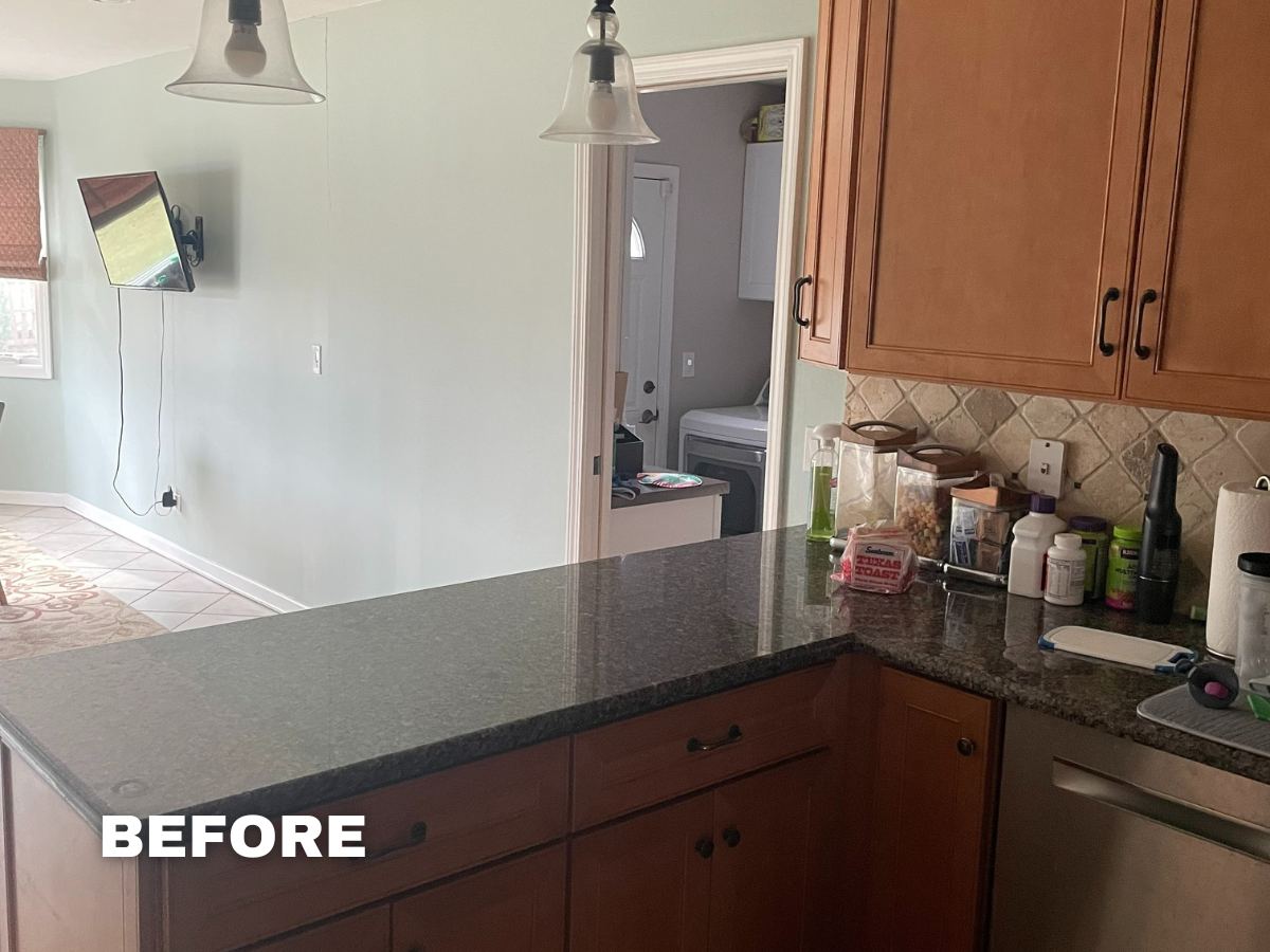 Before-2